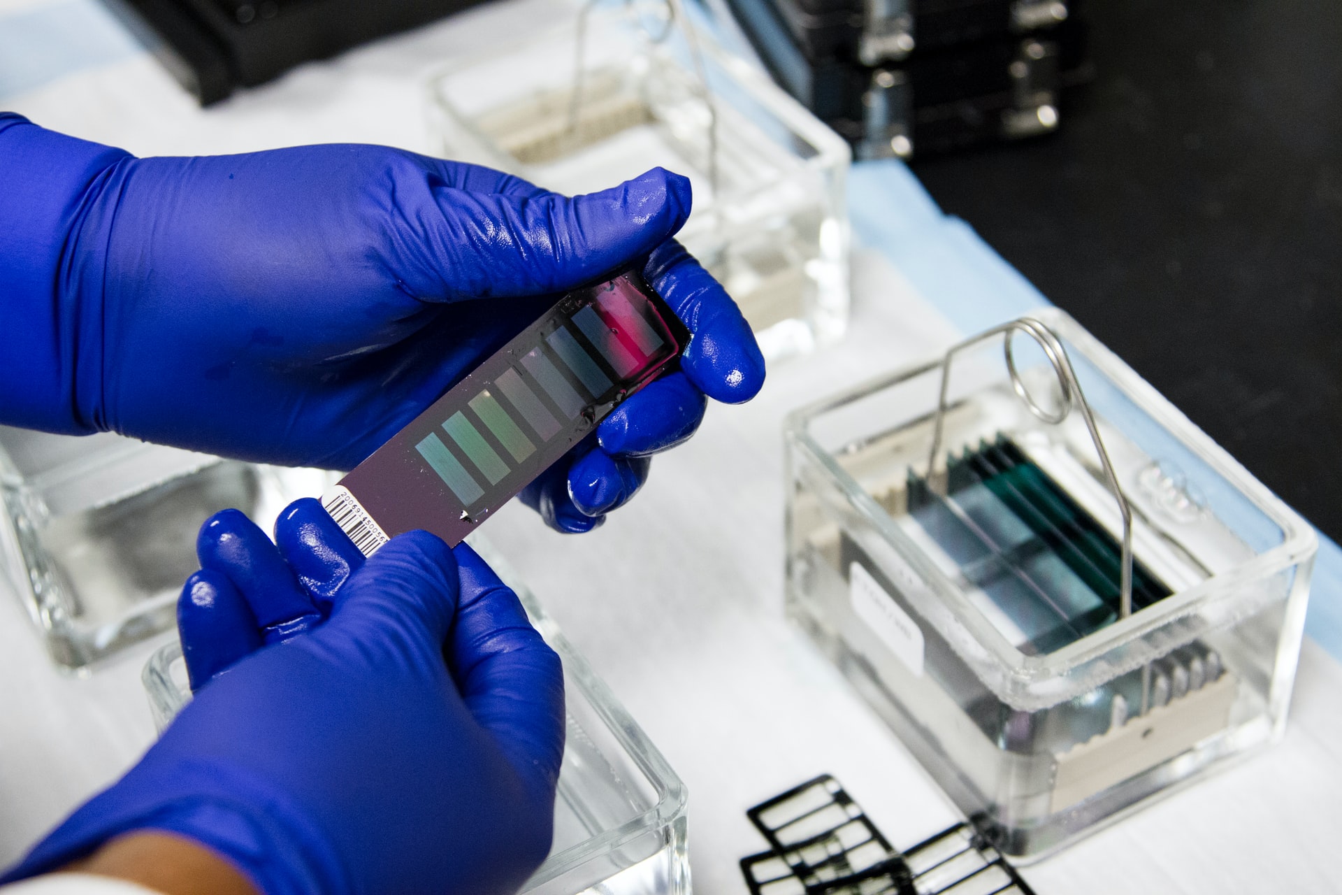 nuevo-estudio-identifica-los-biomarcadores-que-podr-an-ser-usados-para